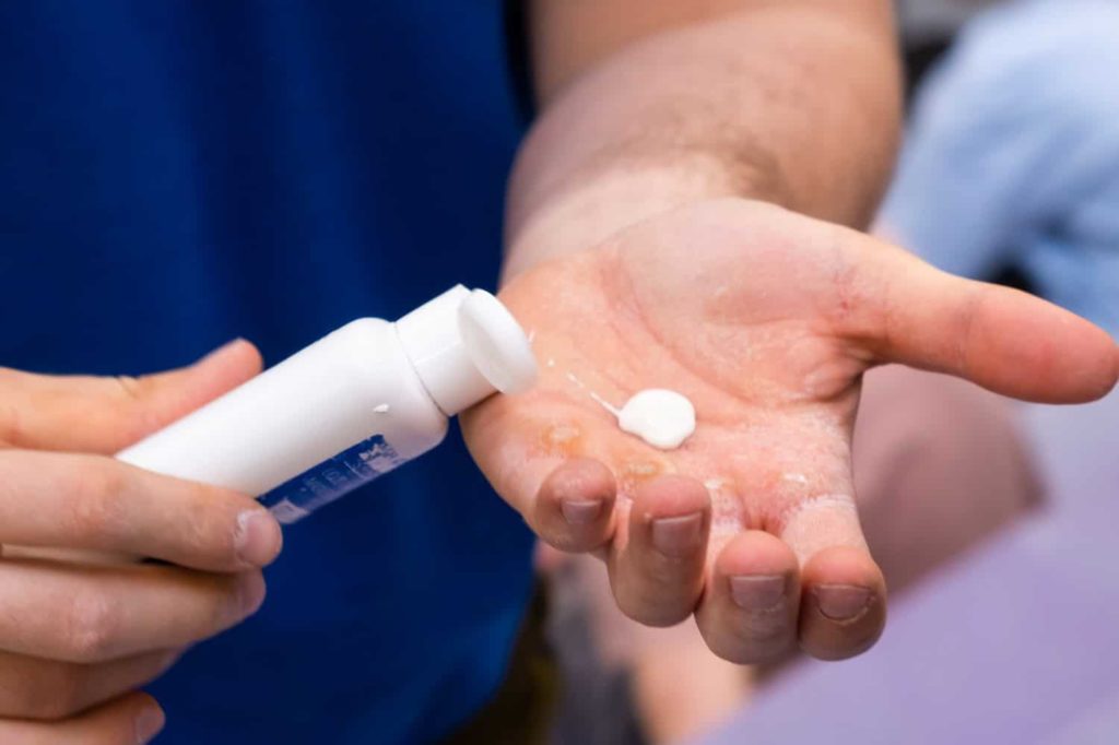 Zinksalbe für was? Anwendungsgebiete, Wirkung und Tipps zur richtigen Anwendung 6 Bepanthen oder Zinksalbe wann verwendet man was mehr bei Wiladu